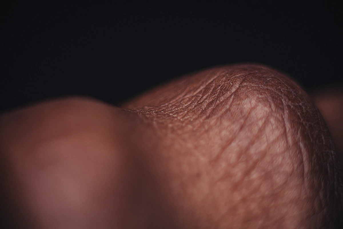 Close-up of natural skin texture, representing a diagnostic consultation