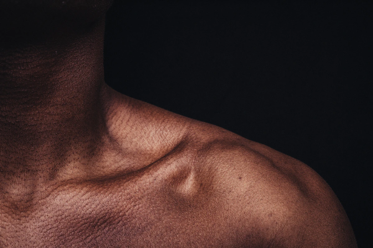 Close-up of a man's bare shoulder and collarbone against a dark background, illustrating rotator cuff and labral shoulder tears.