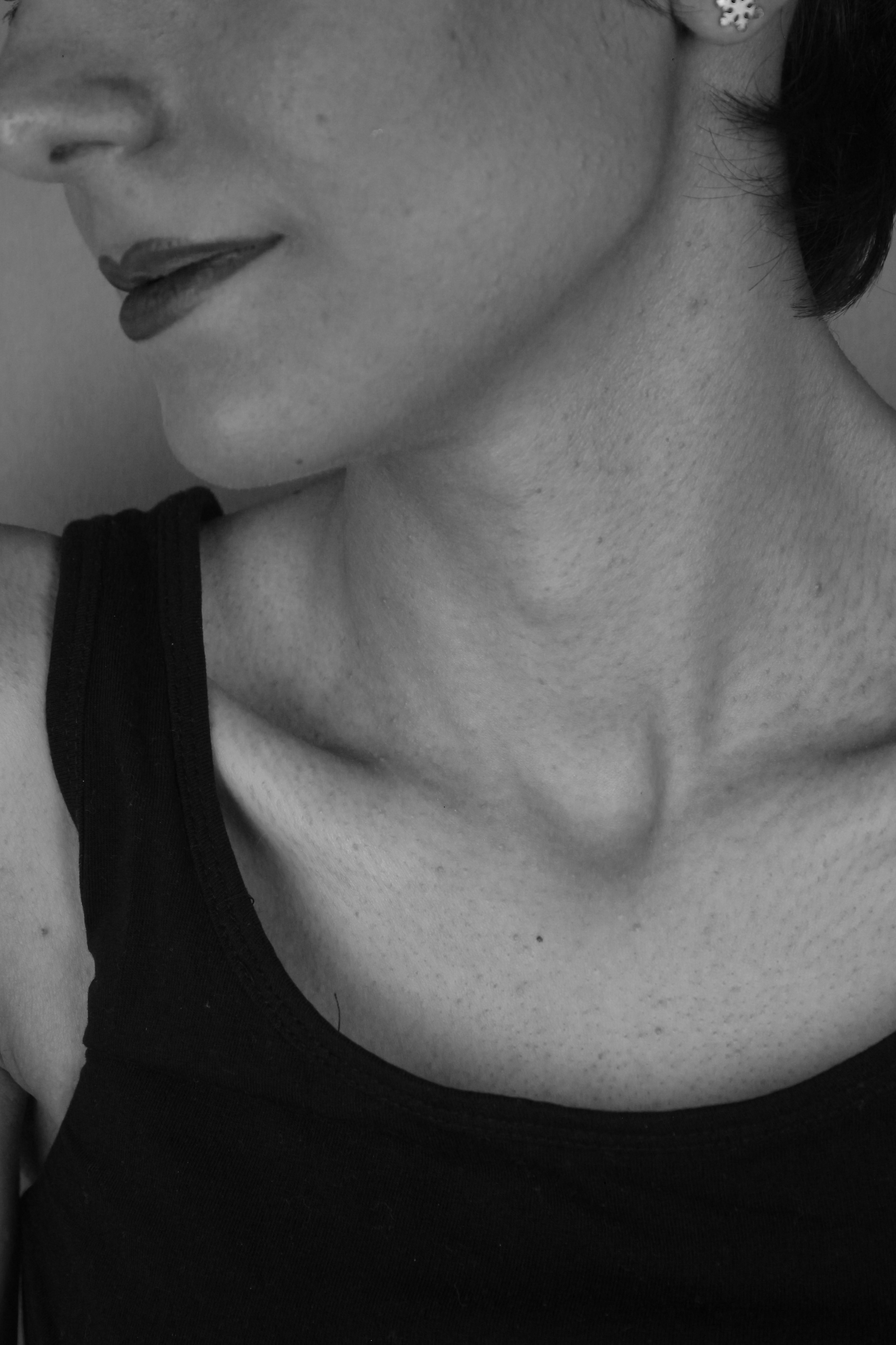 갑상선암 증상 목 이물감 자가진단 및 수술 후 식단 관리와 재발 방지 팁 이미지2