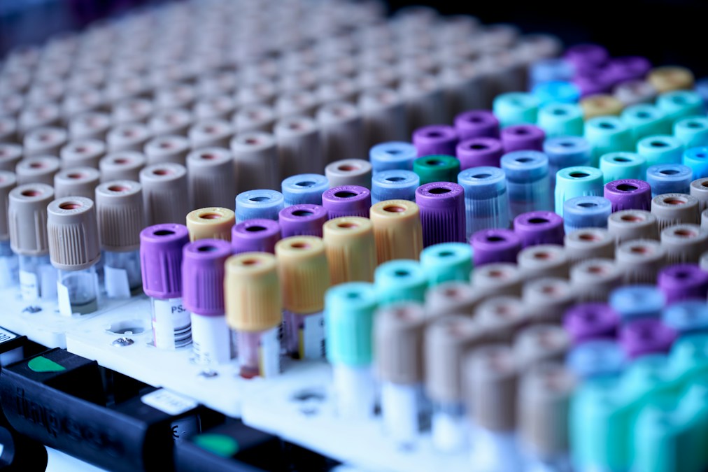 Tubes de prélèvement sanguin aux bouchons colorés rangés dans un portoir de laboratoire (photo d'illustration)