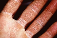 persons palm in close up photography