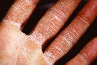persons palm in close up photography