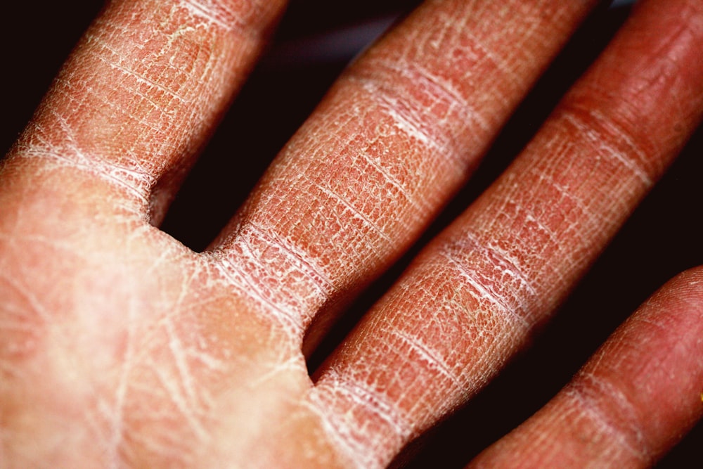 persons palm in close up photography