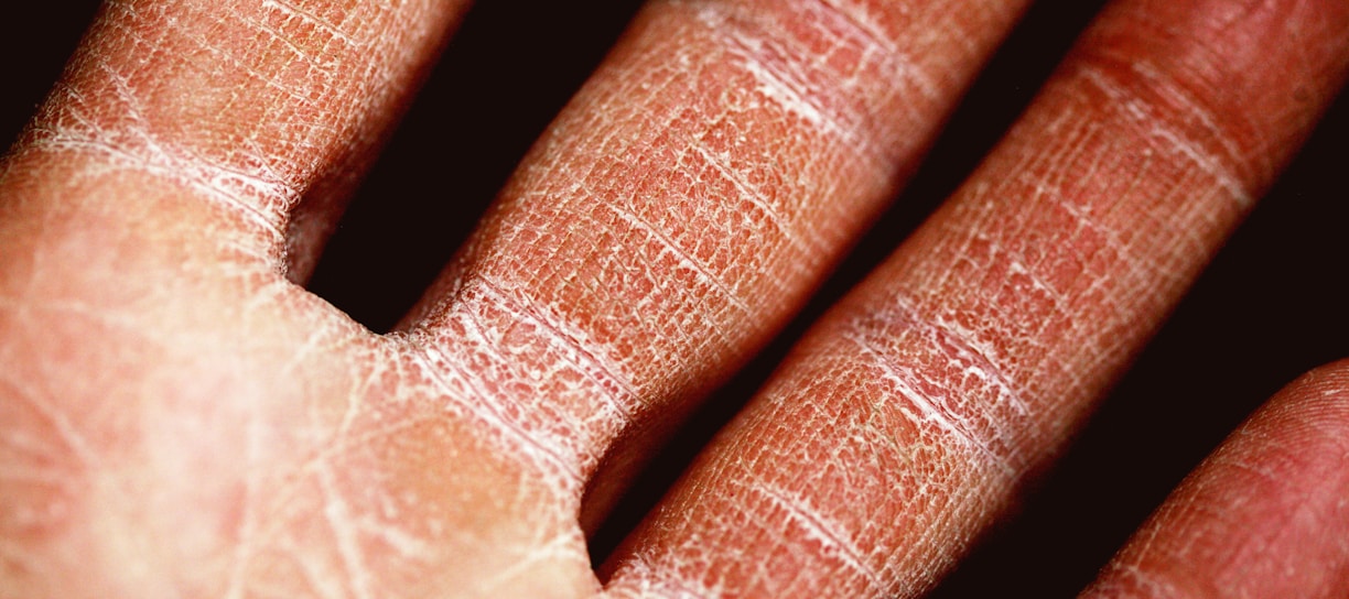 persons palm in close up photography