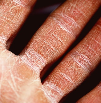 persons palm in close up photography