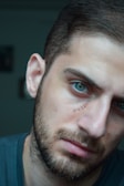 A man with a serious expression is shown having facial stitches near his eye. He has a short beard and piercing blue eyes, and the lighting creates a somber, introspective atmosphere.