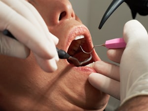 Essential Factors to Consider When Choosing Dental Insurance