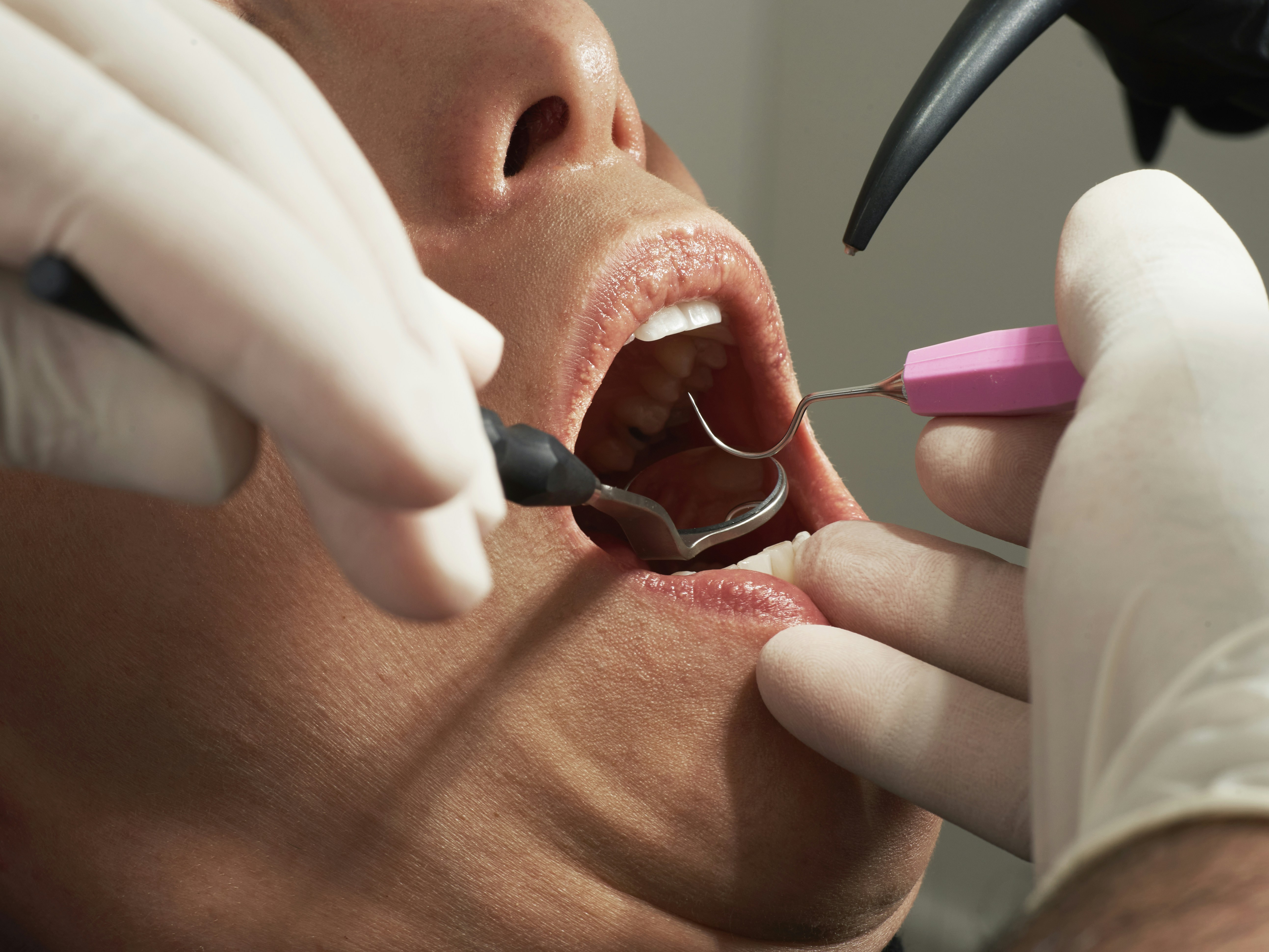 Cosmetic Dentist In East English Village Detroit Michigan Mich MI