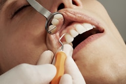 Teeth Cleaning Cost in Greater Noida