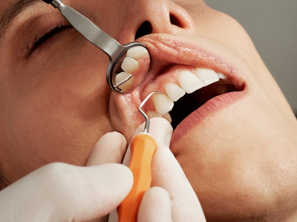 What is Preventative Dental Care