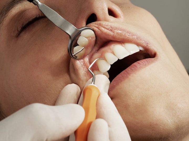 Everything about dental bonding cementing
