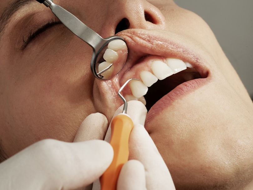 Dentist examining a patient's teeth with a mirror during a dental exam