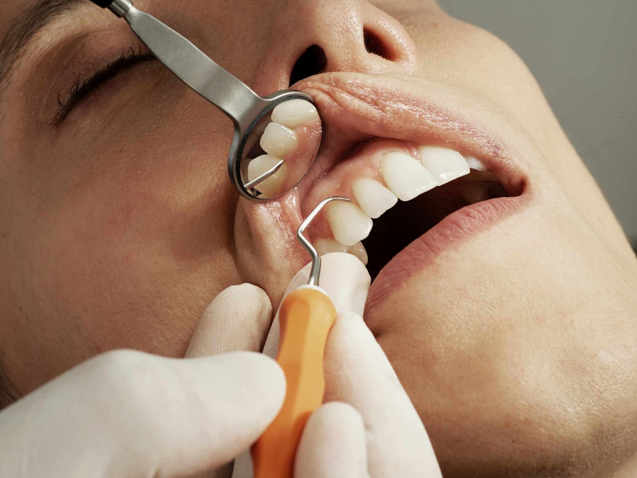 Preventive dental care check-up