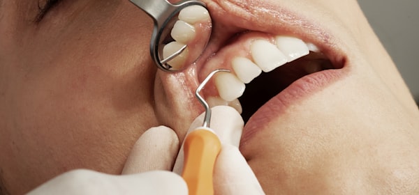 Standard dental implant procedure