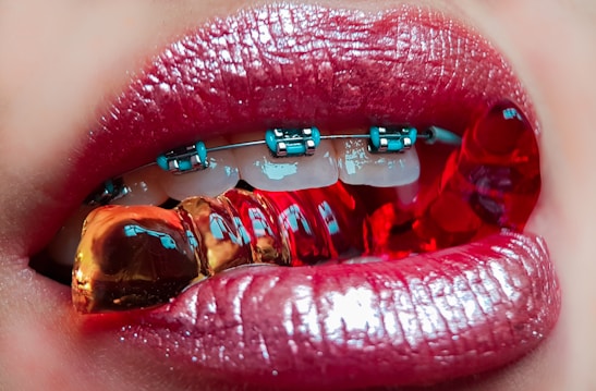 Close-up of lips with shiny red lipstick, revealing braces on the teeth holding translucent red and orange gummy candies.