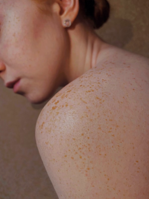 SkinGuardAI skin and mole monitoring app