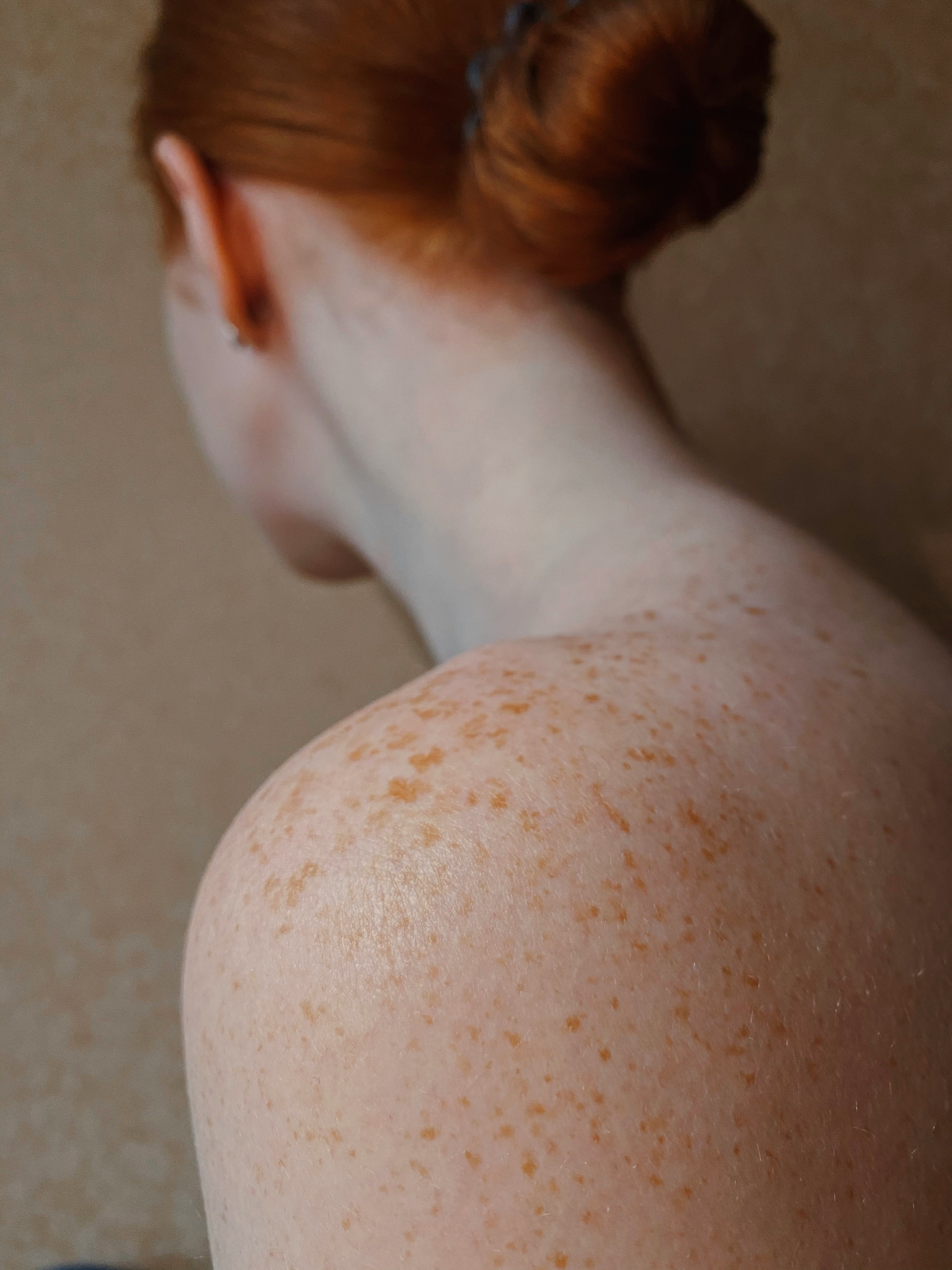 Dry Skin