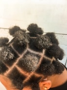 A close-up view of a person's scalp with neatly sectioned hair styled into small, rounded afro puffs. The sections form a grid pattern across the scalp, and each section is tied tightly to create the puffs. The hair is dark and textured.