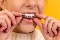 How to wear invisible braces like invisalign or toothsi