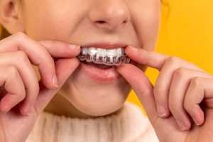 Trồng răng implant