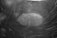 A black and white image featuring a prominent fingerprint on a surface with scratch marks. The texture and details of the fingerprint are clearly visible, suggesting close-up photography.
