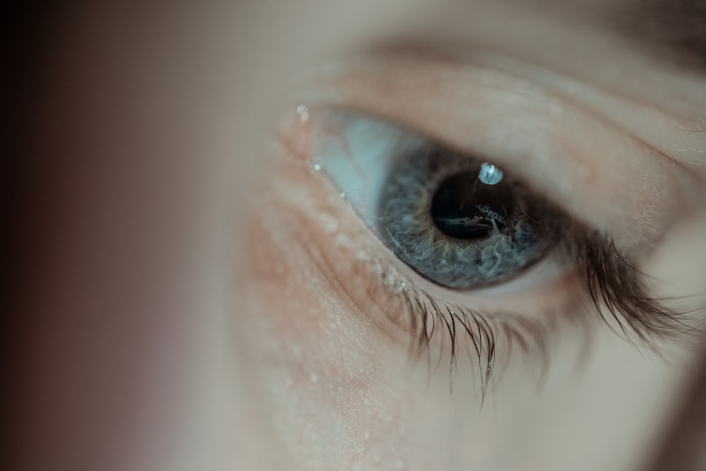 persons eye with black eye