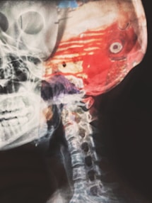 3D rendering of human bones used in forensic identification software.
