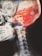 A detailed x-ray image of a human skull and neck with an overlay of bright red and orange colors highlighting muscular and tissue structures. The skeletal structure, including the vertebrae in the neck, is visible.