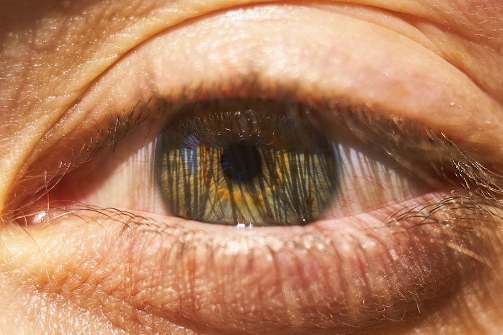 persons eye with green eyes
