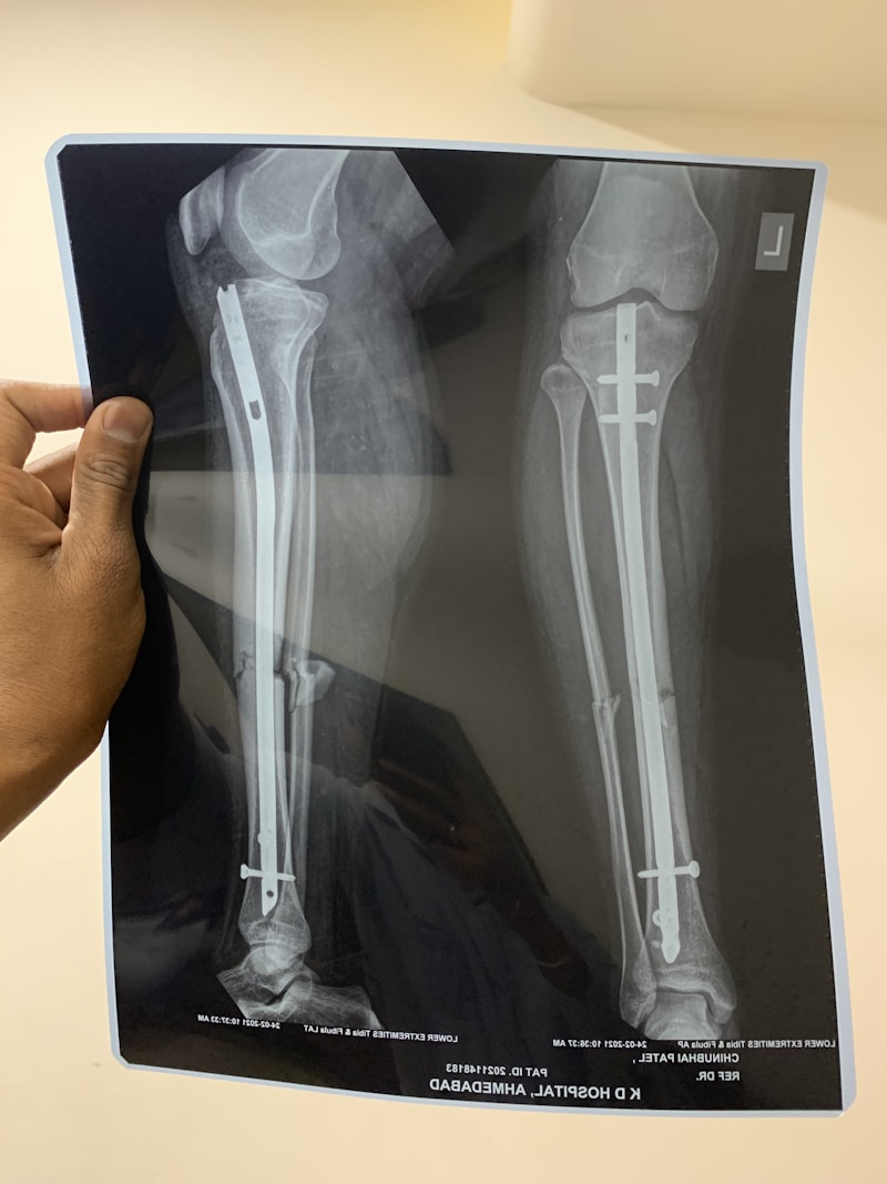 Understanding Robotic Knee Replacement: A Complete Guide