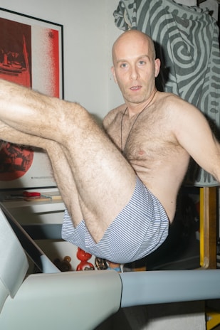 Cartoon style happy client before hair transplant, looking worried and bald.