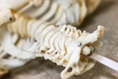 Close-up of hands demonstrating an orthopaedic model to a patient.
