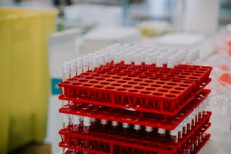 An array of medical test tubes and samples neatly organized on a lab bench.