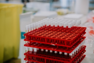 A stack of red racks filled with test tubes, each capped with a white lid, arranged in a clinical or laboratory setting. The background includes various laboratory equipment that is slightly out of focus.