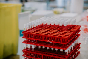 Rows of test tubes filled with blood samples labeled and ready for analysis.