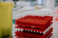 A stack of red racks filled with test tubes, each capped with a white lid, arranged in a clinical or laboratory setting. The background includes various laboratory equipment that is slightly out of focus.