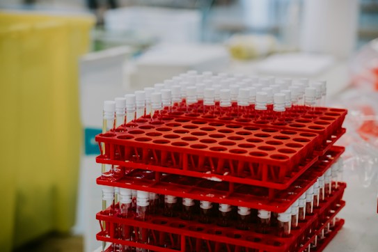 A stack of red racks filled with test tubes, each capped with a white lid, arranged in a clinical or laboratory setting. The background includes various laboratory equipment that is slightly out of focus.