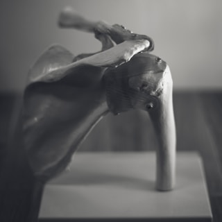 tendinitis supraespinoso