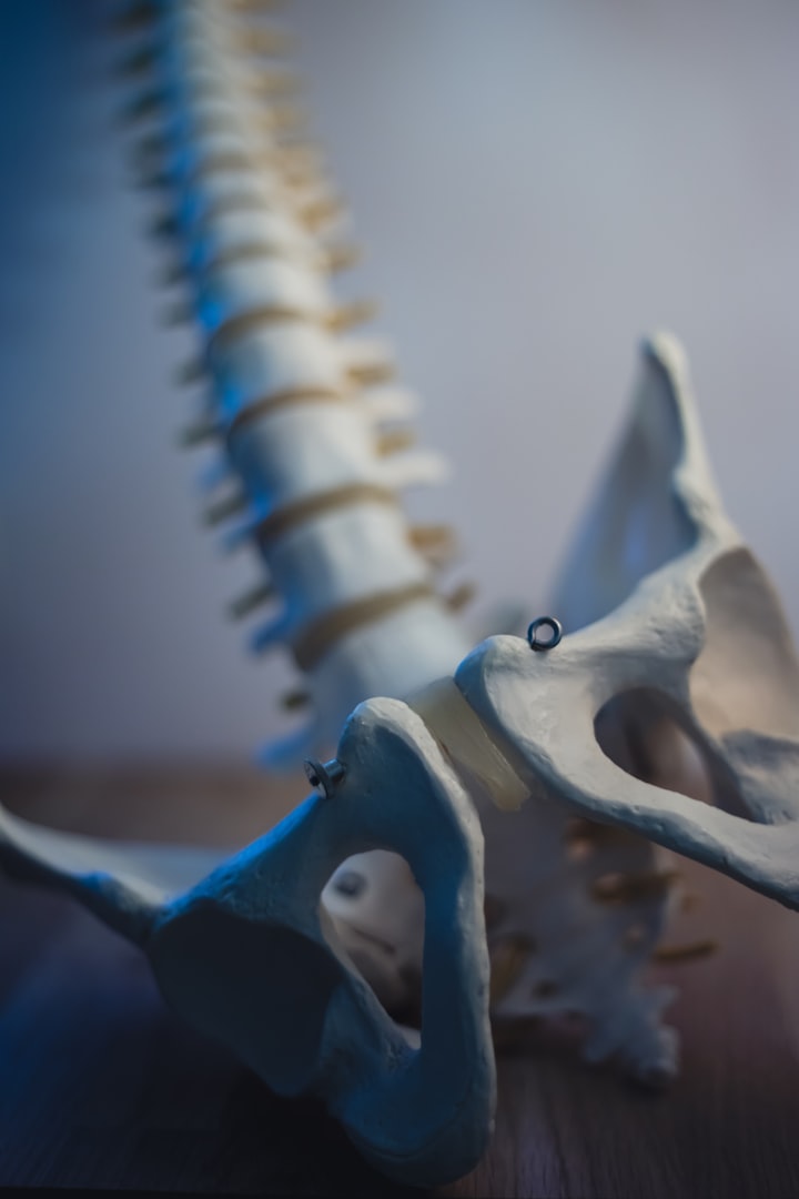 What is Sacroiliac (SI) Joint Dysfunction