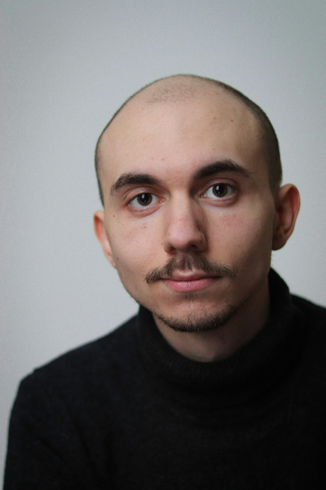 Why Do People Get Scalp Micropigmentation Removed?