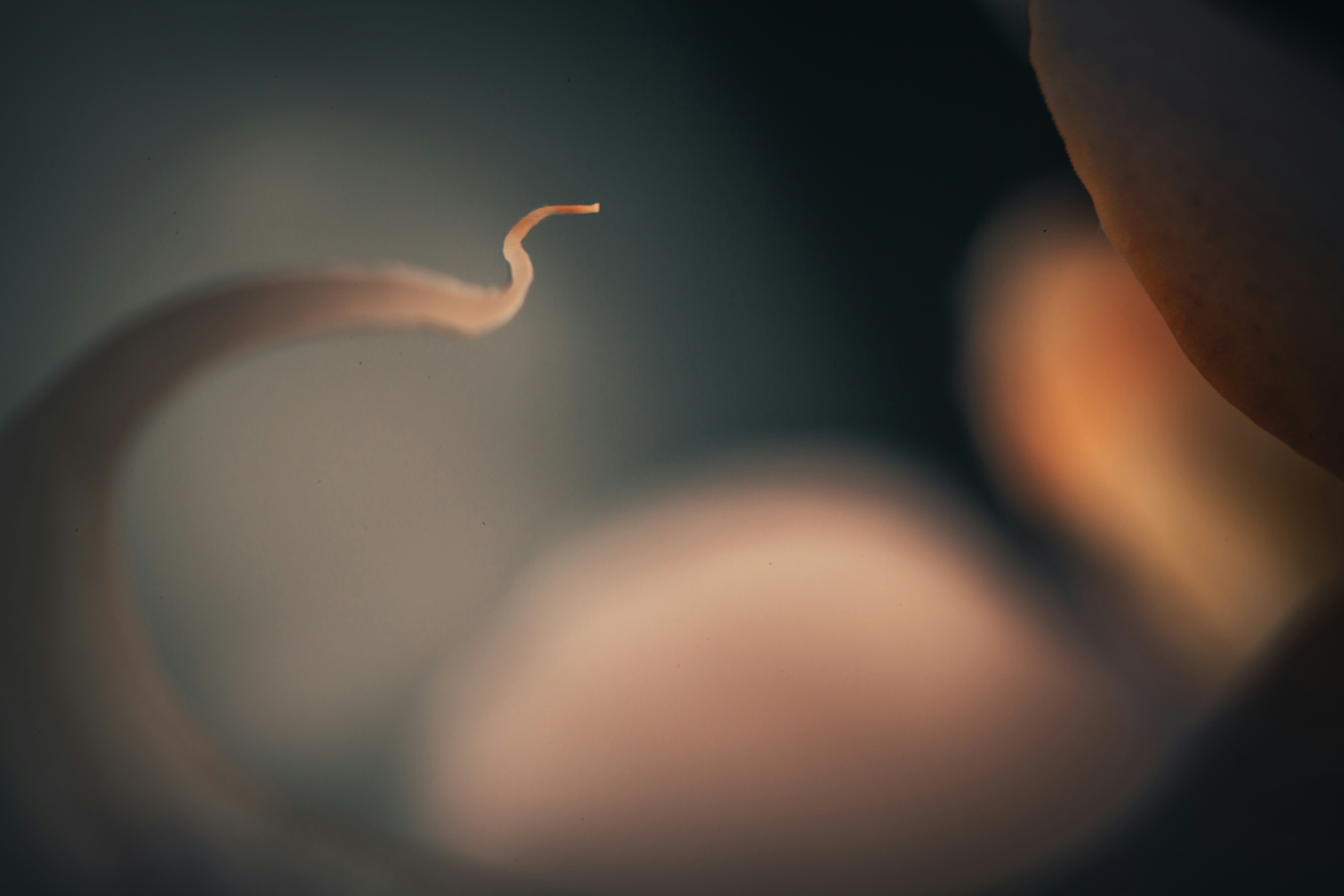 Penerapan Data Mining untuk Klasifikasi Prediksi Penyakit Ispa (Infeksi Saluran Pernapasan Akut) dengan Algoritma Decision Tree (Id3) Image