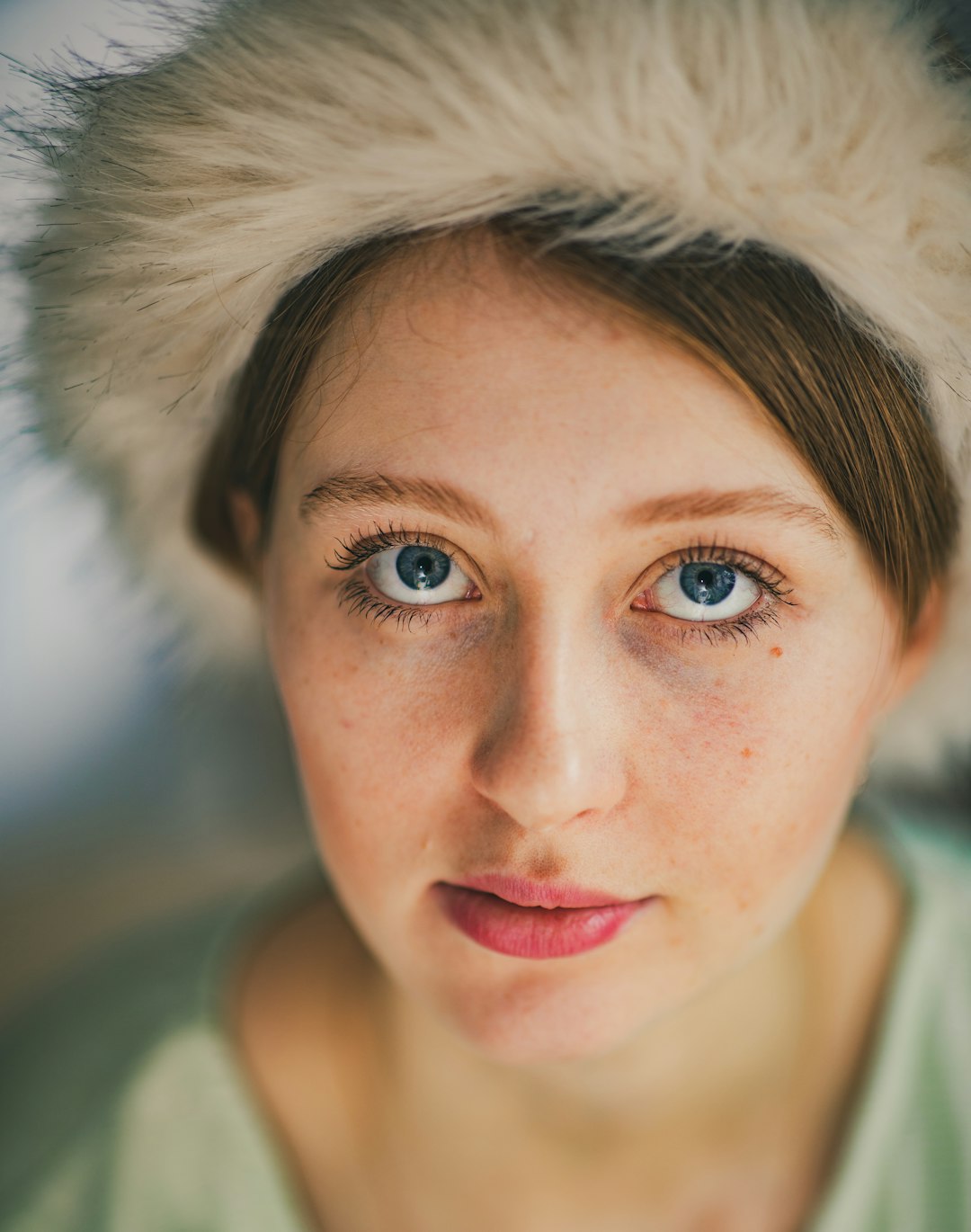 Types of Acne Scars: Pictures, Diagnosis and Treatments