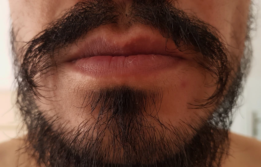 Close-up of a well-groomed man applying beard oil in natural light, showcasing texture and care.