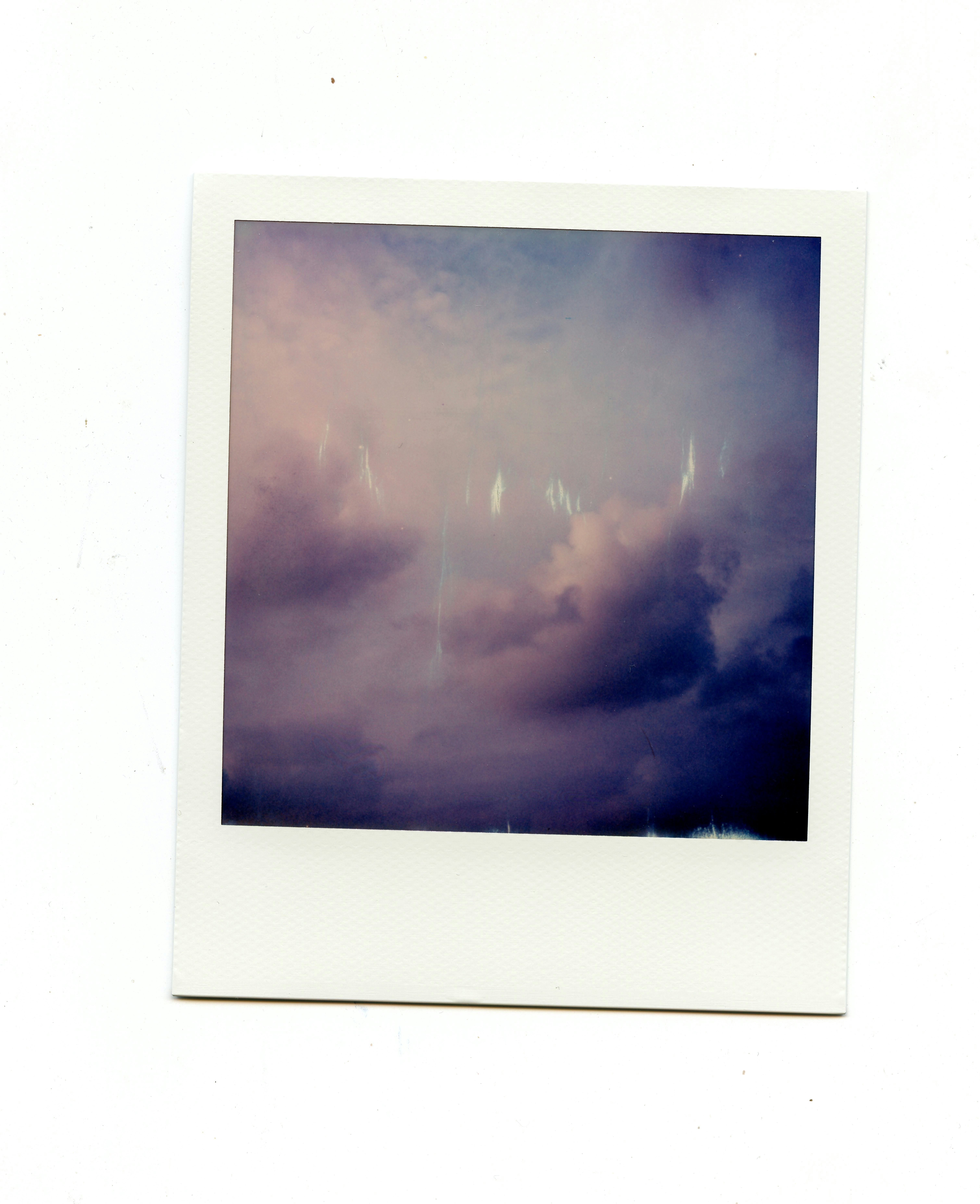 Understanding Delays in MS Diagnosis in Zambia