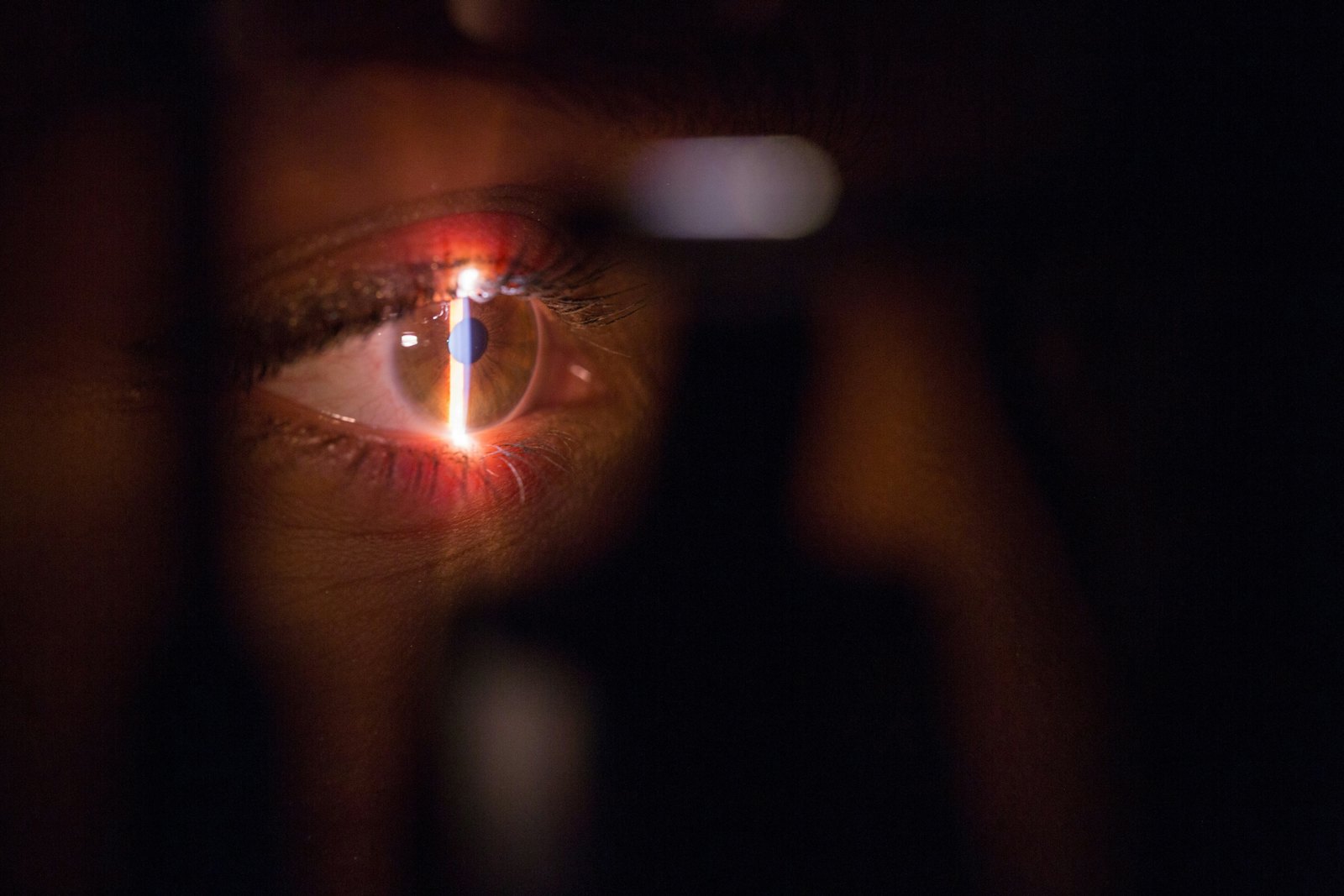 LASIK surgeon performing pre-operative eye examination