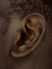 A close-up of a doctor examining a patient's scalp with a dermatoscope.