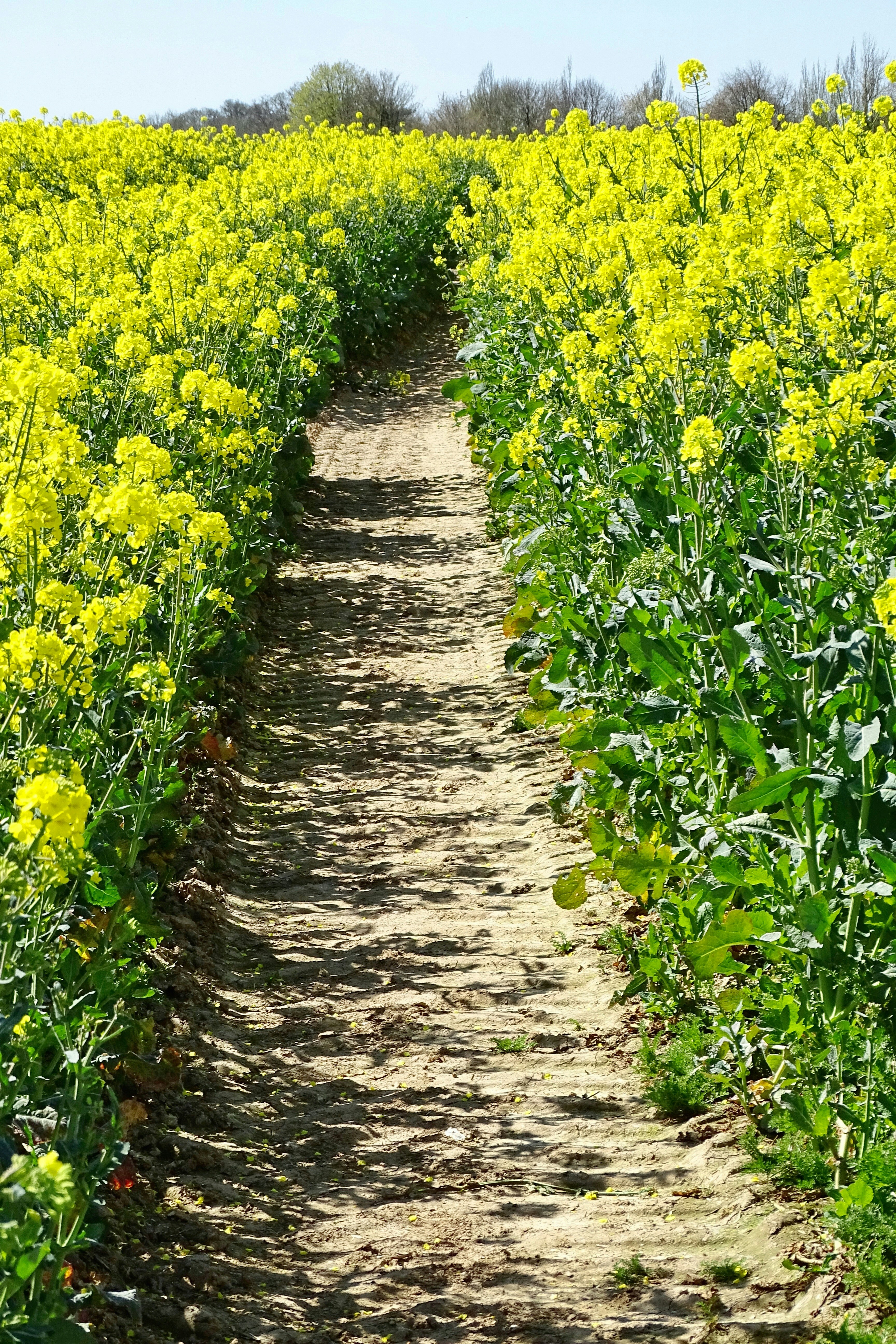 Dura Bright on MRI Linked to More Brain Surface Damage