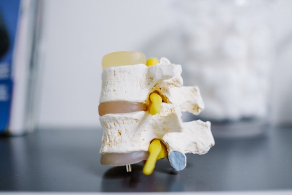 A detailed anatomical model of a human spinal vertebra is displayed on a flat gray surface. The model highlights the bone structure in white with intervertebral discs shown in a beige color. Nerves are represented in yellow, showing the nerves protruding from the spine.