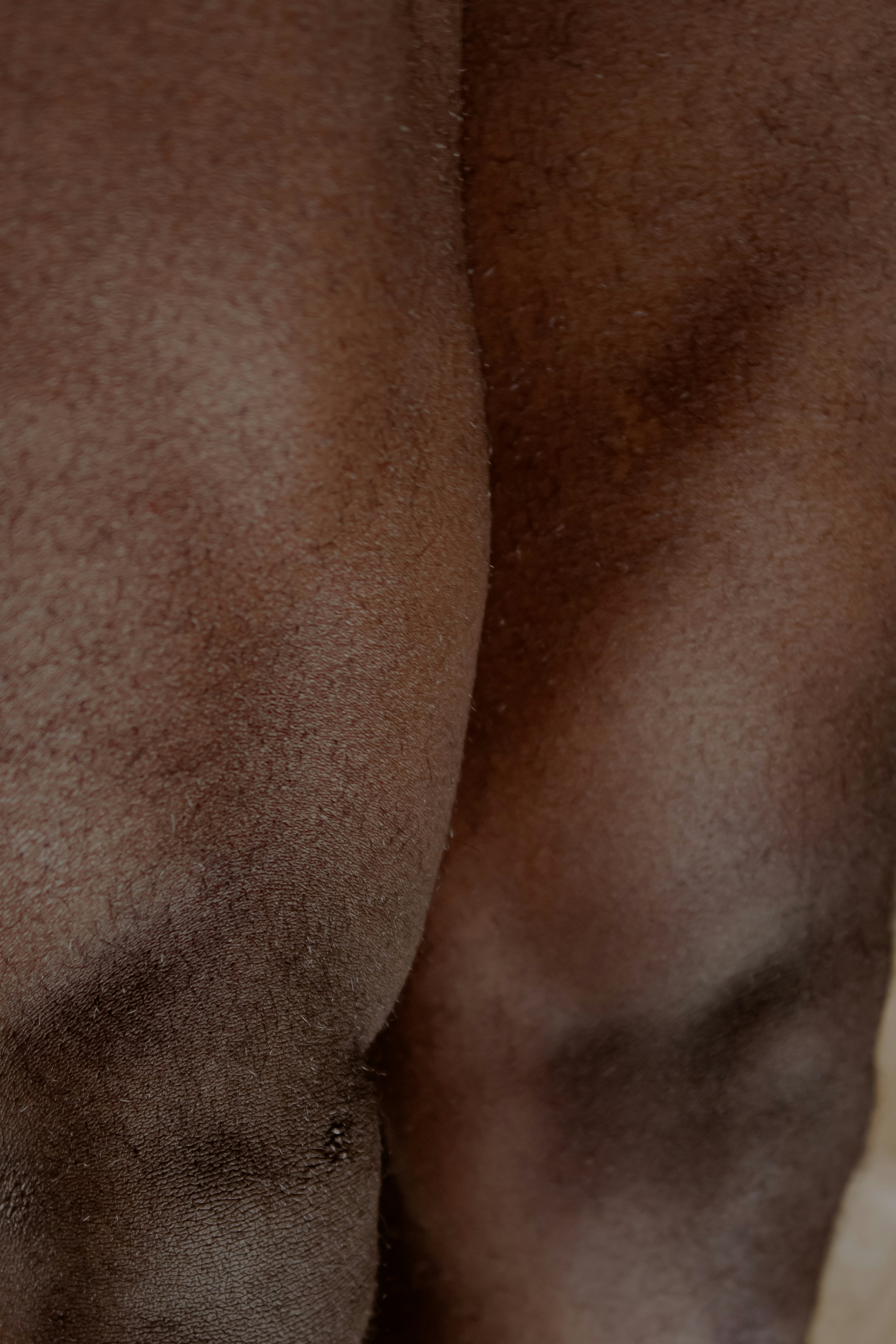 athletic skin texture, wallpaper, Acne Mechanica: Causes, Symptoms & Treatment 6