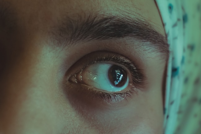 Close-up before and after photo of a patient’s upper eyelid blepharoplasty showing natural rejuvenation.